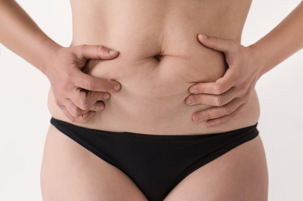 Closeup of woman’s postpartum belly fat